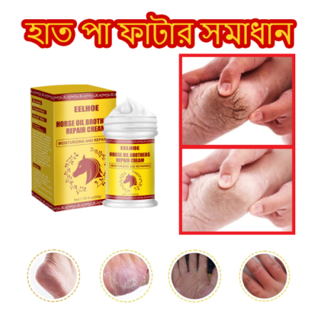পায়ের গোড়ালি ফাটা ও হাত পায়ের চামড়া উঠা সমস্যার 100% কার্যকরী সমাধান