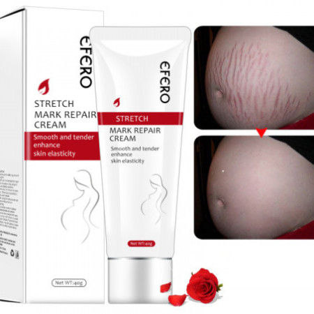 Efero Stretch Mark Repair Cream