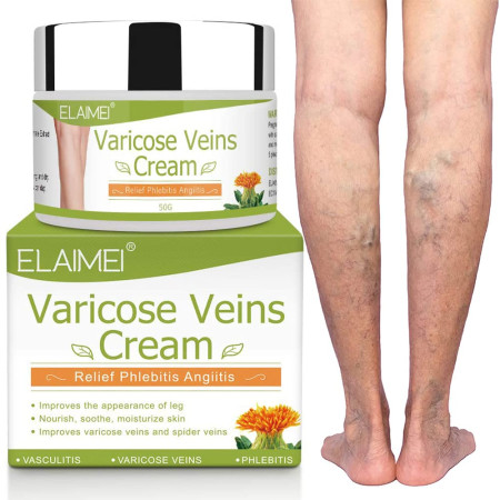 Varicose Veins Cream