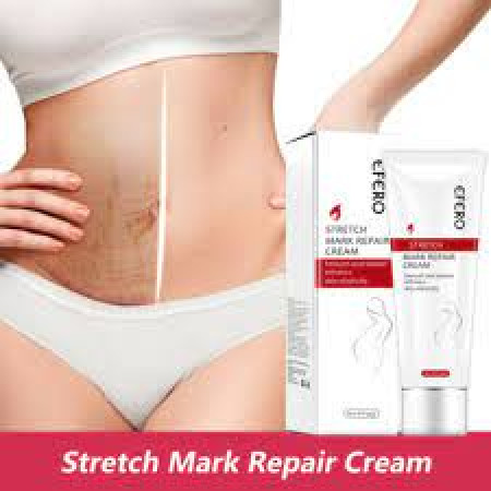 Efero Stretch Mark Repair Cream